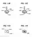 Fig. 11 - Injection zone markers for biomedical implants
