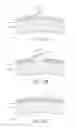 Fig. 18 - Ocular mask having selective spectral transmission