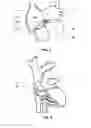 Fig. 02 - System and method for reducing tricuspid regurgitation