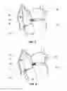 Fig. 05 - System and method for reducing tricuspid regurgitation