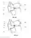 Fig. 07 - System and method for reducing tricuspid regurgitation