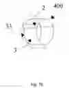 Fig. 14 - METHOD OF MAKING A PROSTHETIC VALVE AND VALVE OBTAINED THEREWITH