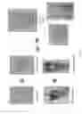 Fig. 27 - ARTIFICIAL, FLEXIBLE VALVES AND METHODS OF FABRICATING AND SERIALLY EXPANDING THE SAME