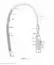 Fig. 02 - Methods and apparatus for endovascularly replacing a patient's heart valve