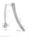 Fig. 03 - Methods and apparatus for endovascularly replacing a patient's heart valve