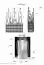 Fig. 09 - Stent-valves for valve replacement and associated methods and systems for surgery