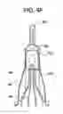 Fig. 12 - Stent-valves for valve replacement and associated methods and systems for surgery