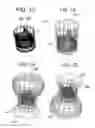 Fig. 16 - Stent-valves for valve replacement and associated methods and systems for surgery
