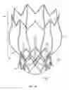 Fig. 02 - Two-stage collapsible/expandable prosthetic heart valves and anchoring systems