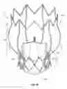 Fig. 03 - Two-stage collapsible/expandable prosthetic heart valves and anchoring systems