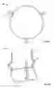 Fig. 05 - Two-stage collapsible/expandable prosthetic heart valves and anchoring systems