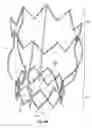 Fig. 12 - Two-stage collapsible/expandable prosthetic heart valves and anchoring systems