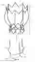 Fig. 15 - Two-stage collapsible/expandable prosthetic heart valves and anchoring systems