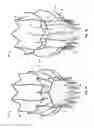 Fig. 02 - Collapsible/expandable prosthetic heart valves with native calcified leaflet retention features
