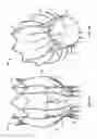 Fig. 03 - Collapsible/expandable prosthetic heart valves with native calcified leaflet retention features