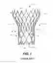 Fig. 02 - Paravalvular leak protection