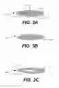 Fig. 04 - Paravalvular leak protection
