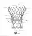 Fig. 05 - Paravalvular leak protection
