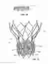 Fig. 08 - Paravalvular leak protection