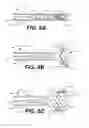 Fig. 09 - Paravalvular leak protection