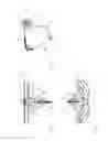Fig. 03 - Implant and method for improving coaptation of an atrioventricular valve