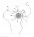Fig. 01 - Implant Fixation Device