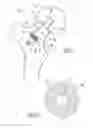 Fig. 05 - Implant Fixation Device