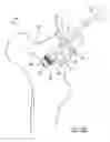 Fig. 16 - Implant Fixation Device