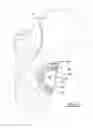 Fig. 23 - Implant Fixation Device