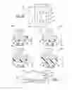 Fig. 03 - Convertible pre-partial knee replacement