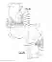 Fig. 05 - Convertible pre-partial knee replacement