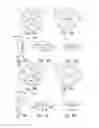 Fig. 19 - PATELLA RESURFACING PROSTHESIS