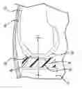 Fig. 01 - Knee prosthetic implant