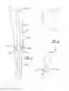 Fig. 02 - Knee prosthetic implant