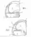 Fig. 03 - Knee prosthetic implant