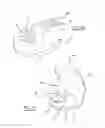 Fig. 08 - Knee prosthetic implant