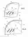 Fig. 22 - Knee prosthetic implant