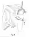 Fig. 05 - Modular reverse shoulder orthopaedic implant and method of implanting the same