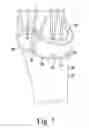 Fig. 06 - Modular reverse shoulder orthopaedic implant and method of implanting the same