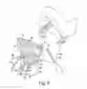 Fig. 08 - Modular reverse shoulder orthopaedic implant and method of implanting the same