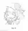 Fig. 12 - Modular reverse shoulder orthopaedic implant and method of implanting the same