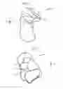 Fig. 07 - System and method for non-binding allograft subtalar joint implant