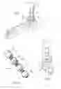 Fig. 03 - Ankle replacement system