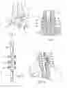 Fig. 04 - Ankle replacement system