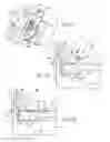 Fig. 16 - Ankle replacement system