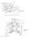 Fig. 17 - Ankle replacement system