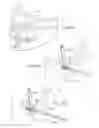 Fig. 19 - Ankle replacement system