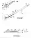 Fig. 15 - METHODS AND APPARATUS FOR ACCESSING AND TREATING THE FACET JOINT
