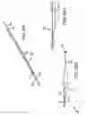Fig. 21 - METHODS AND APPARATUS FOR ACCESSING AND TREATING THE FACET JOINT