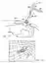 Fig. 13 - Inside-out guide for hip replacement method